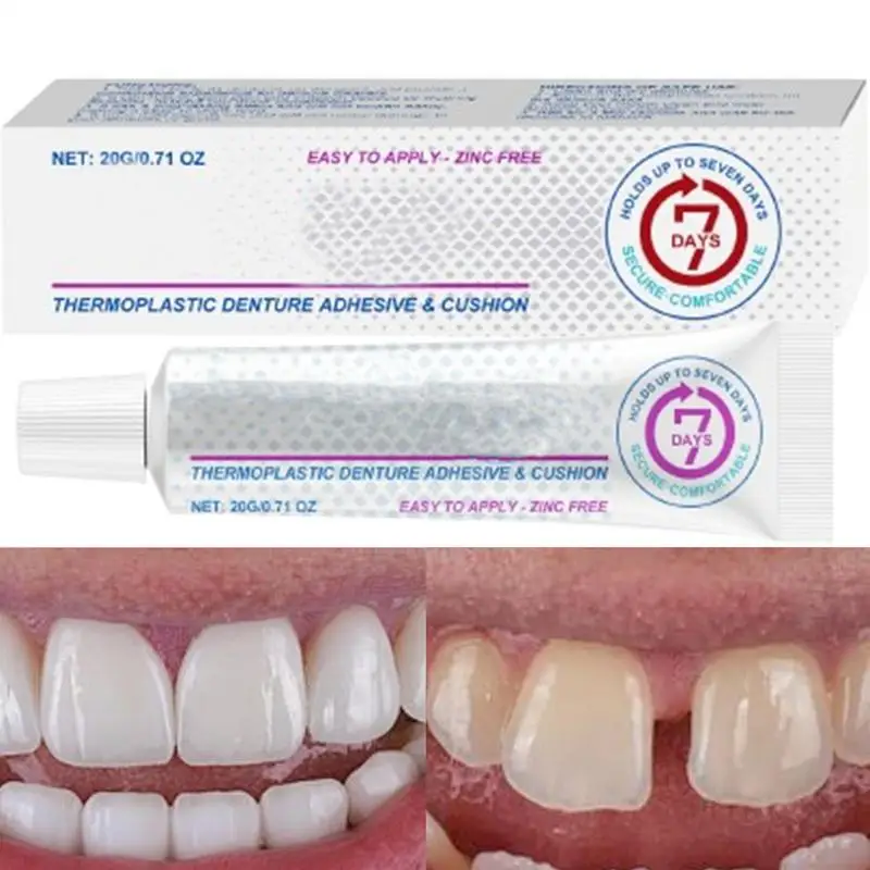 Thermoplastic Denture Adhesive Glue Long-lasting Holding Denture Reliner For Dentures Refits And Tightens Loose Denture Care