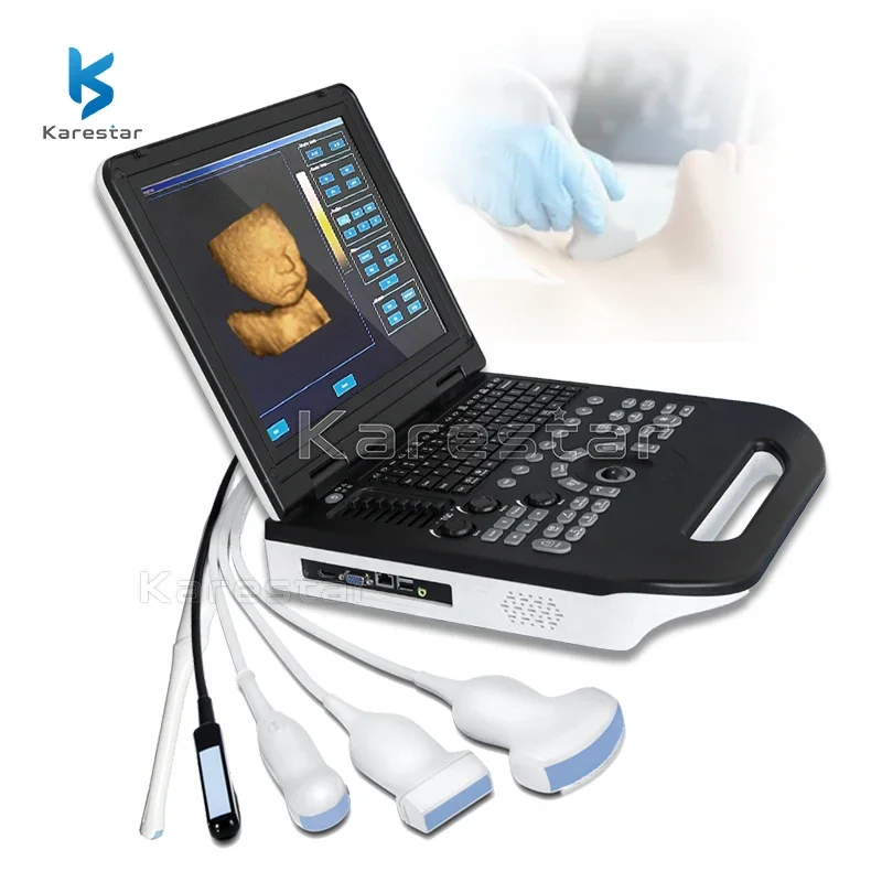 15 Inches LCD Screen Gynecology Use Best Quality Portable 3D Color Doppler Ultrasound Machine