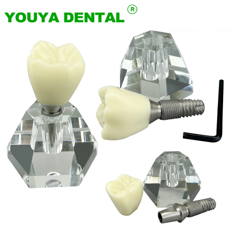 Dental Teeth Model 4 Times Single Tooth Crown Implant Training Demonstration Tool Dentistry Dentist Student Teaching Study Model