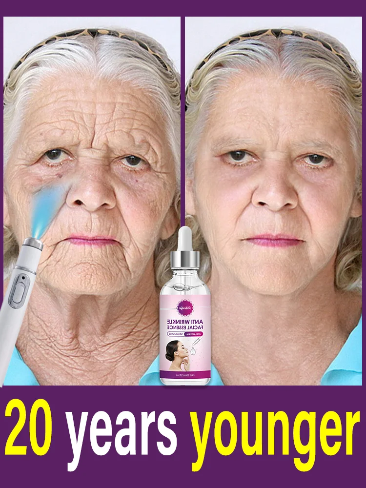 Resserrez votre peau et regardez 20 ans plus jeune. Achetez-en 2 obtenez 1 gratuit, achetez-en 3 obtenez 2 gratuits, achetez-en 5 obtenez 5.