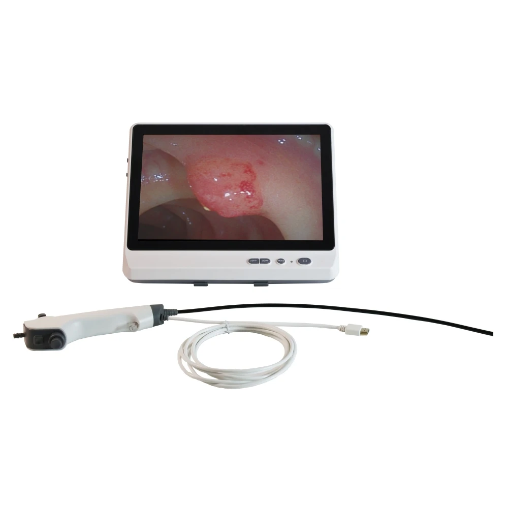 Camjoy Best Selling 2.8 3.8 4.8 5.2 5.8 mm Disposable Portable Flexible Bronchoscope