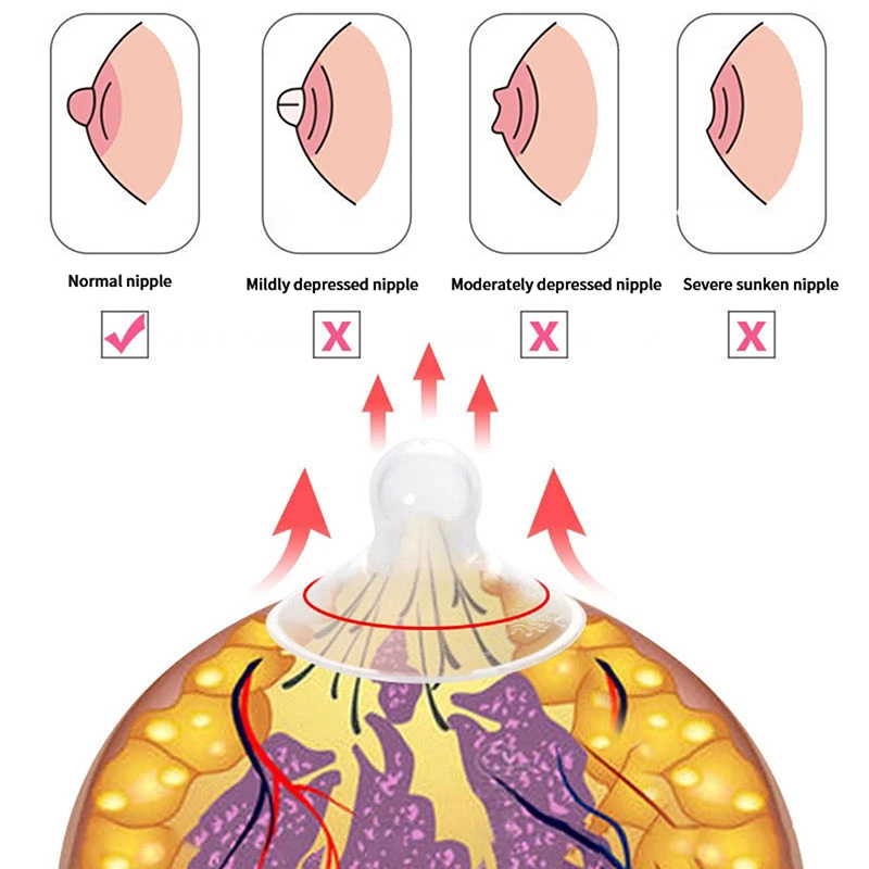 مصحح حلمة من السيليكون مع جراب شفاف ، حلمات مسطحة مقلوبة للأمهات والنساء المرضعات ، 2 *