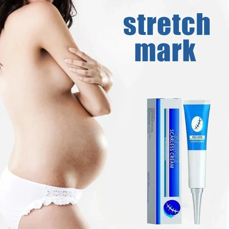 HOT SALE Non-irritating Stretch Mark Cream Scar Slack Line Repairing for Pregnant Woman