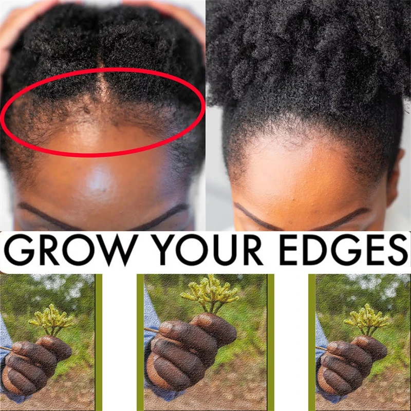 Africa Crazy Hair Edges Growth Traction Alopecia Chebe Powder Thicken Hair Shampoo Hair Loss Treatment Wildly Grow Long hair