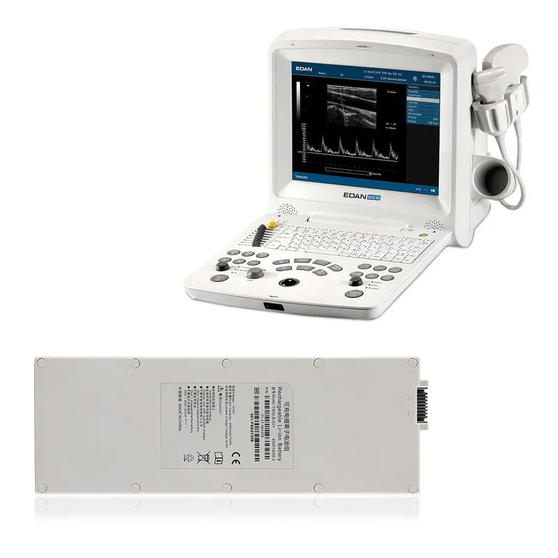 TWSLB-001 TWSLB-001-SDI Lithium Replacement Battery Fit EDAN DUS60 Portable Ultrasound Diagnostic Device Libang  Power Source