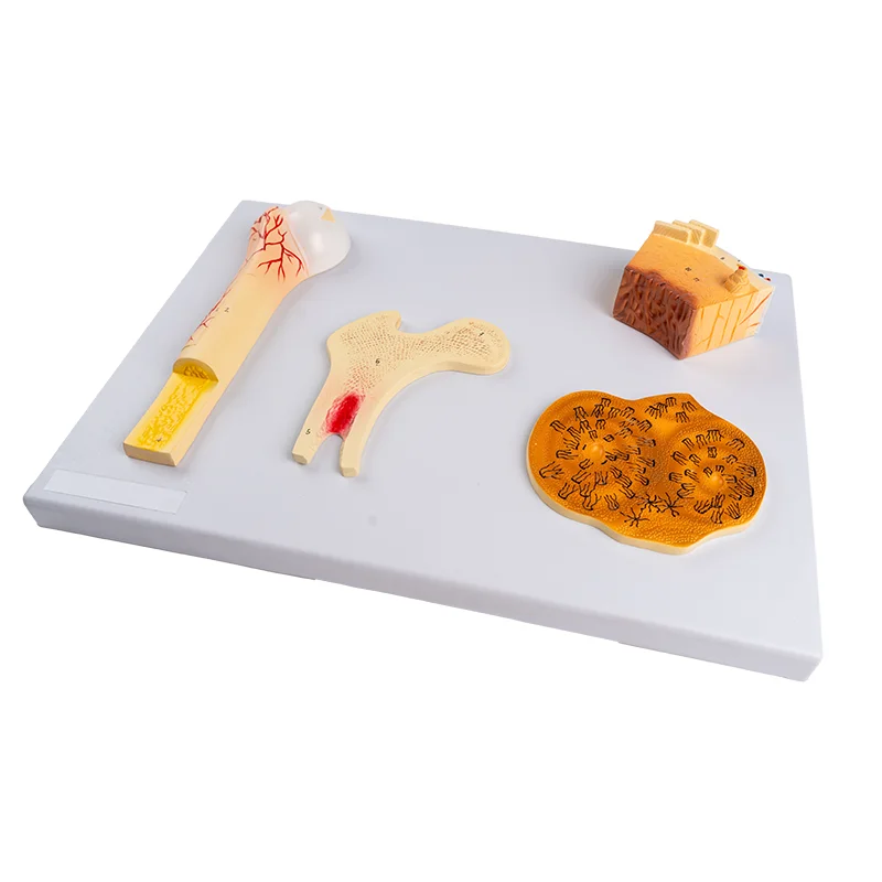 

Bone Structure Model with 4 Parts Trabecular Bone Compact Bone Femur and Haversian System Skeletal Model.