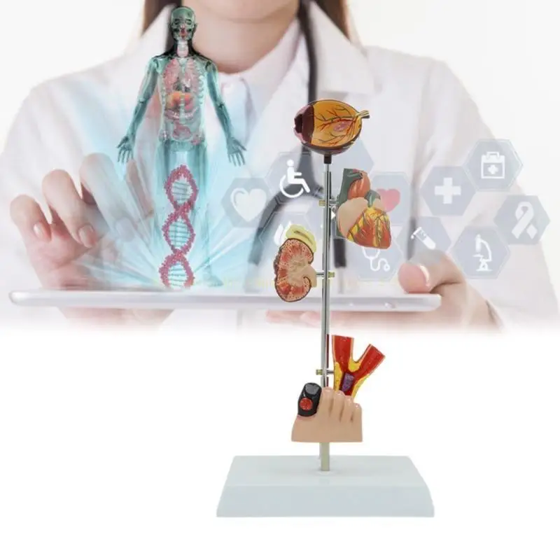 

Pathological Kidney Anatomy Model for Diseases Study, Human Diabetes Pathology Demonstration Model Medical Teaching Aids