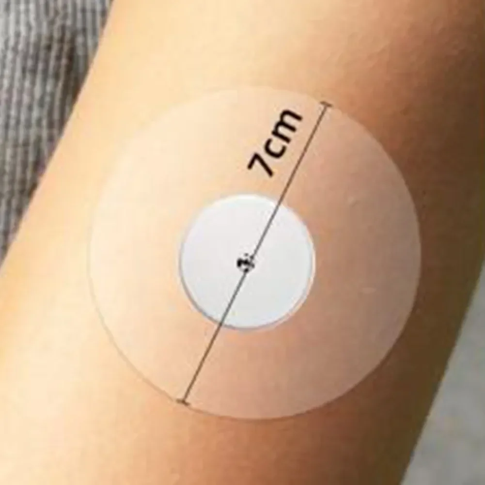 25-delige buitensportpatch Draagbare sensor Rond Transparant Verbeter het comfort en bevestiging Zelfklevende patch