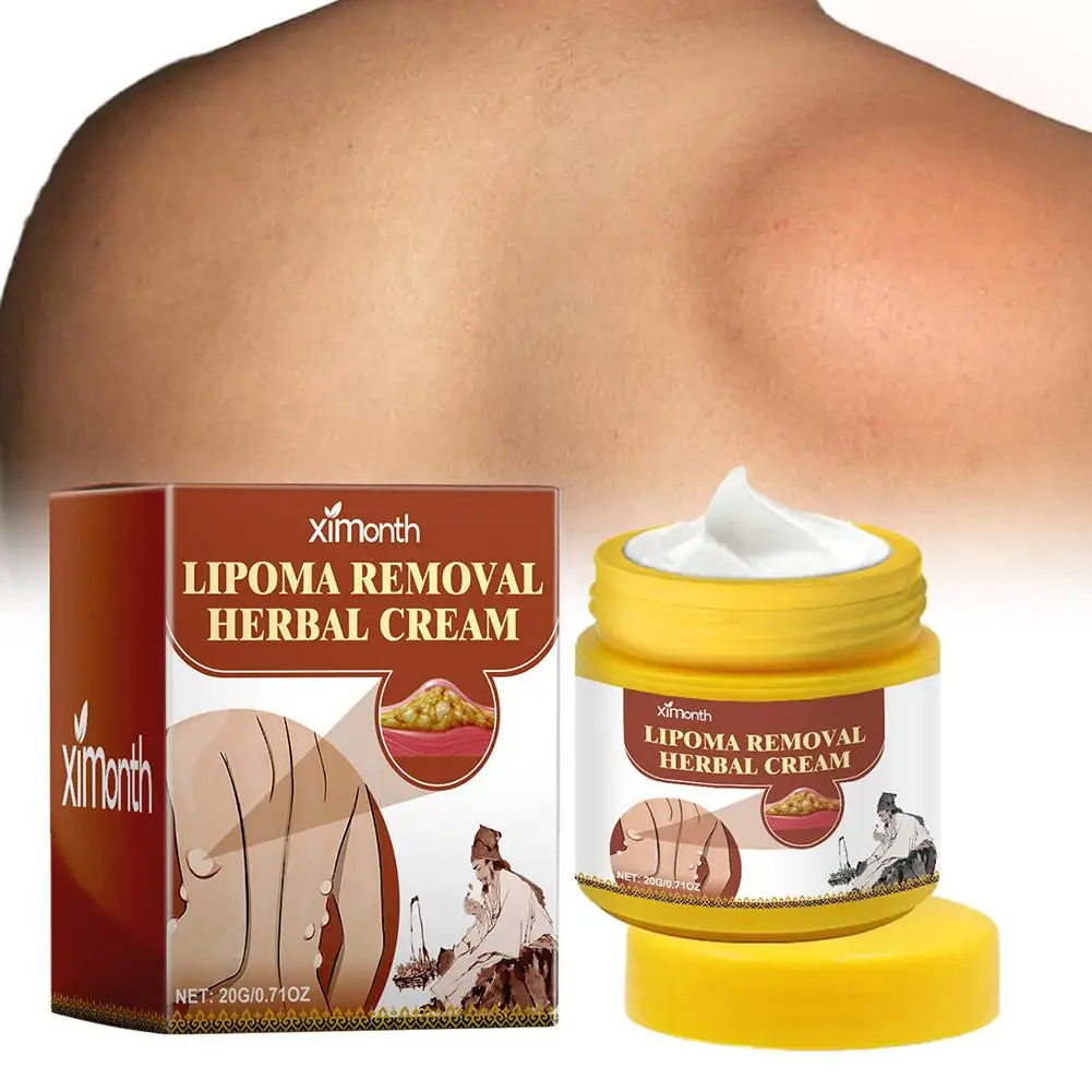 Creme Corporal Herbal Lipoma Removal, Dissolvendo Gordura, Fácil de Usar, 20g, 1Pc