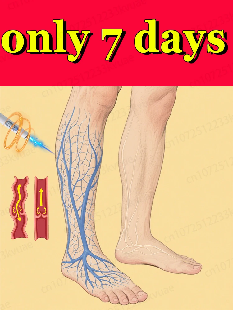 

Say goodbye to spider legs in 24 hours and make blood flow back more easily