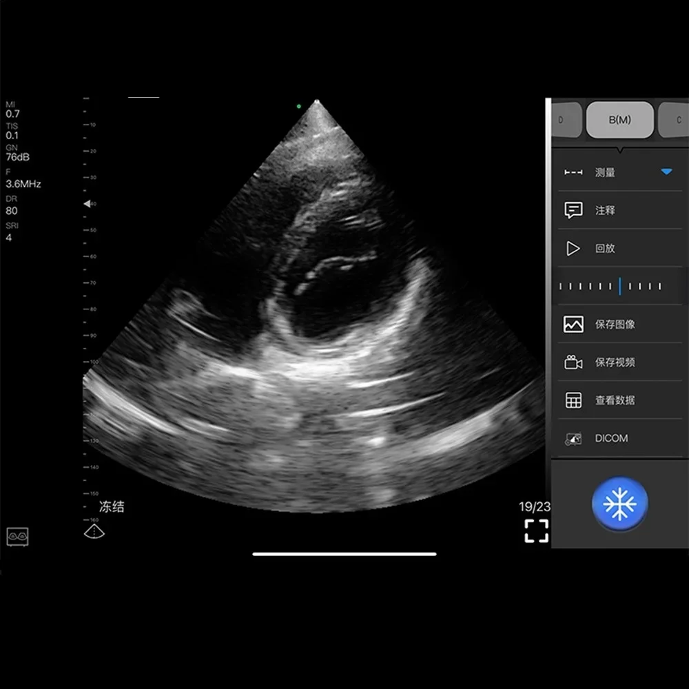 Phased Array Cardiac Probe Wireless Color Ultrasound Scanner Portable Wifi-scanner  64 Elements, with CF, PW, PDI  Function