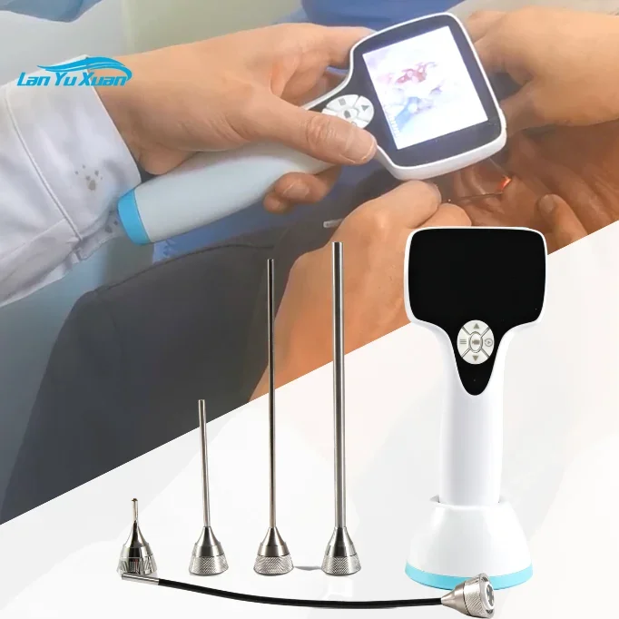 

Otoscope BESDATA Digital Medical Factory Price Wireless ENT Endoscope Video Otoscope for Ears Nose Throat Examination Veterinary