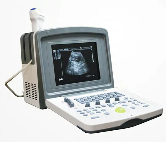 

New High Quality Portable Cardiac Ultrasound Machine