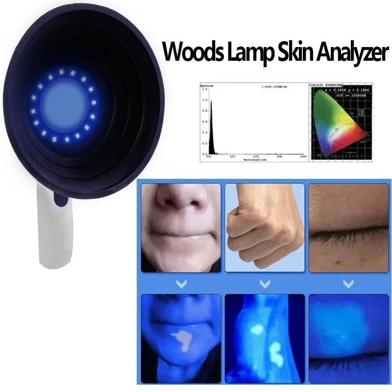 Skin Analyzer With Woods Lamp Portable Vitiligo Detector Analysis Machine LED Rechargeable Lights For Home Use Equipment