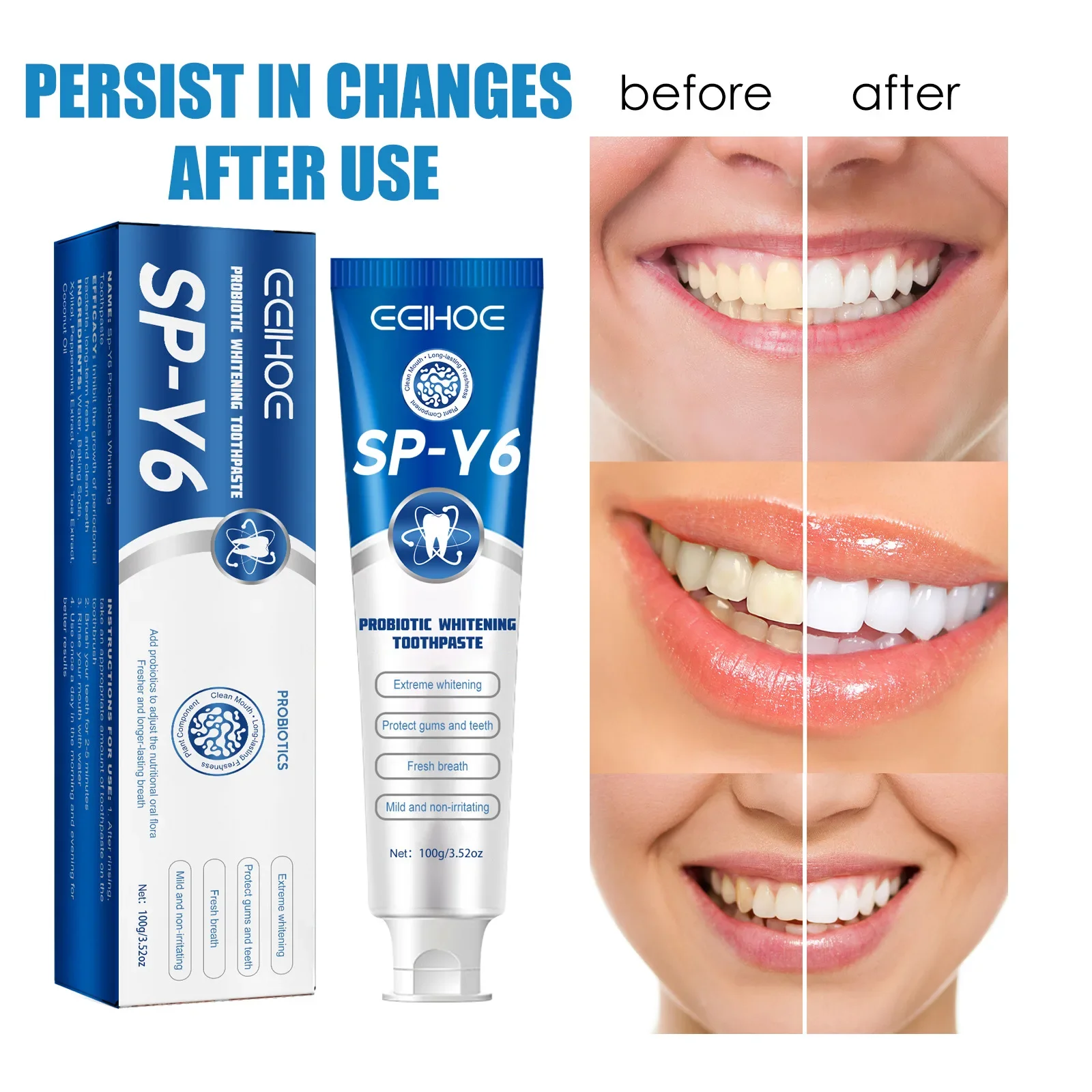 

Sp-y6 Probiotic Whitening Shark Toothpaste Teeth Whitening Toothpaste Oral Care Toothpaste Fresh Breath Prevents Plaque