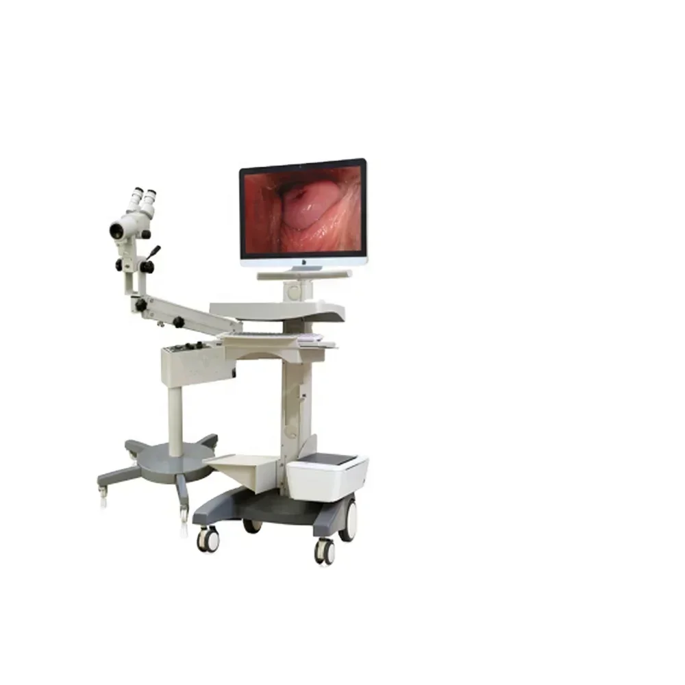 Hot sale Video colpo scope Medical Digital Video colpo scope Visual colpo scope