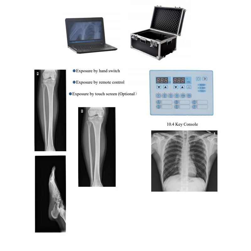 medical hospital high frequency x ray equipment 60mA portable mobile x-ray machine price