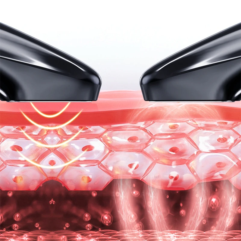 Air Acne Removal Instrument Household Plasma Ozone Mite Elimination Acne Facial Acne Tightening Beauty Instrument