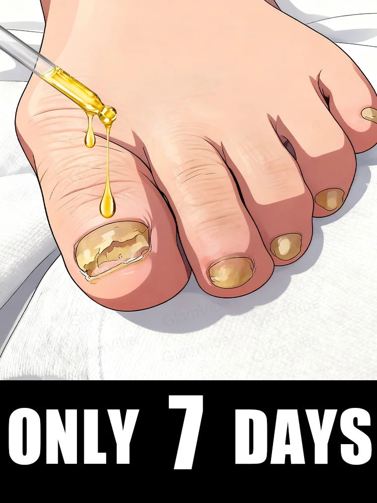 

ᑫᵘⁱᶜᵏ ᵀʳᵉᵃᵗᵐᵉⁿᵗ⸴ ᔆᵃʸ ᴳᵒᵒᵈᵇʸᵉ ᵗᵒ ᶠᵘⁿᵍᵃˡ ᴺᵃⁱˡ ᵂᵒʳʳⁱᵉˢHot-selling nail cleaning brush