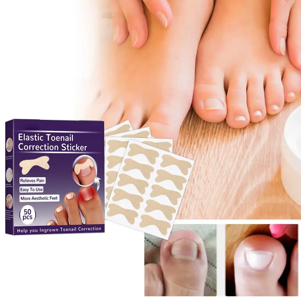 Toe Nail Patch Improve Nail Gutter Toe Nail Protection Correct Misaligned Nails Nail Gutter Correction Nail Care Stickers