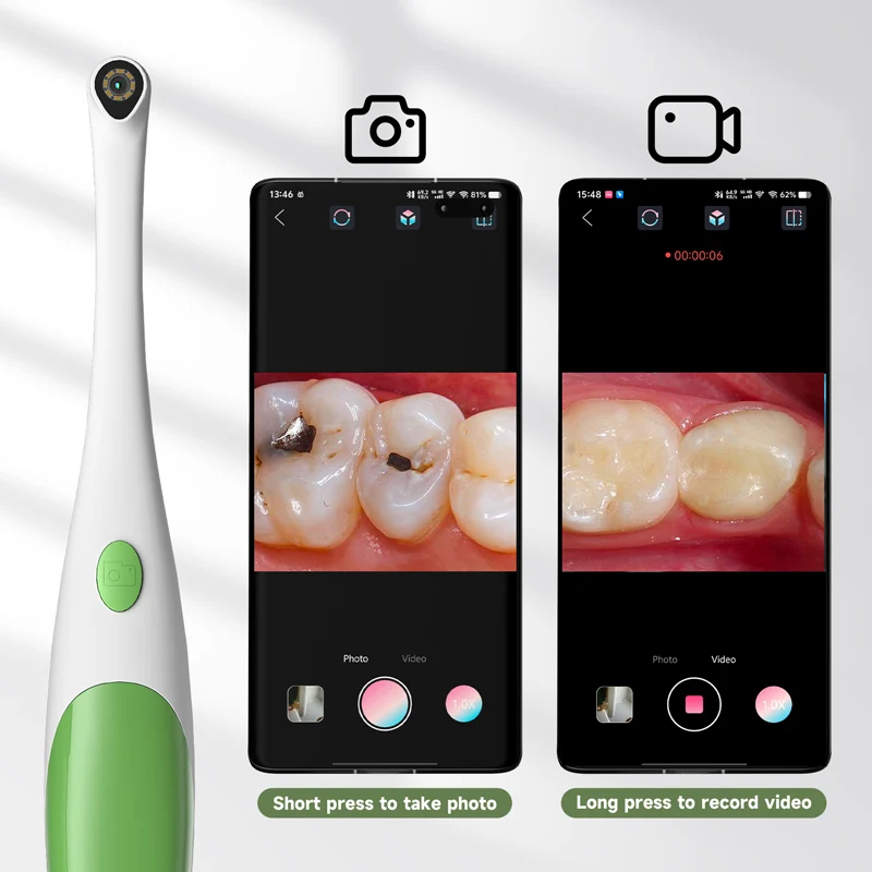 كاميرا أندرويد عن طريق الفم 3 في 1 لنوع C/أندرويد/الكمبيوتر 1080P منظار يدوي 1080P فحص جلد الأسنان للصحة 480P #3