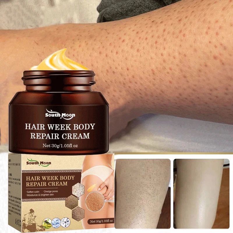 

Curing Keratosis Pilaris Repair Cream Chicken Follicle Skin Body Scrub Brighten Dark Spots Remove Smooth Moisturize Skin Care