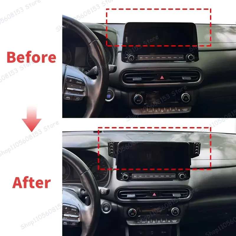 For Hyundai Kona 2021 2022 2023 RHD LHD Adjustable Clip Phone Mount Car Holder Stable No Shake Dashboard Accessory Universal