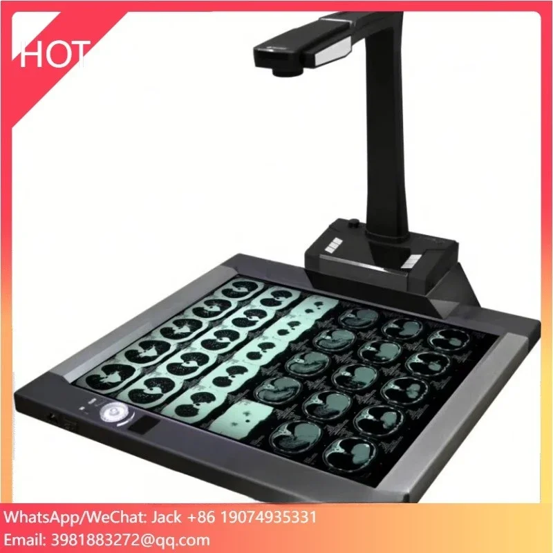 Scanner de filme de raios X Joyusing CT160 para diagnóstico hospitalar e clínico