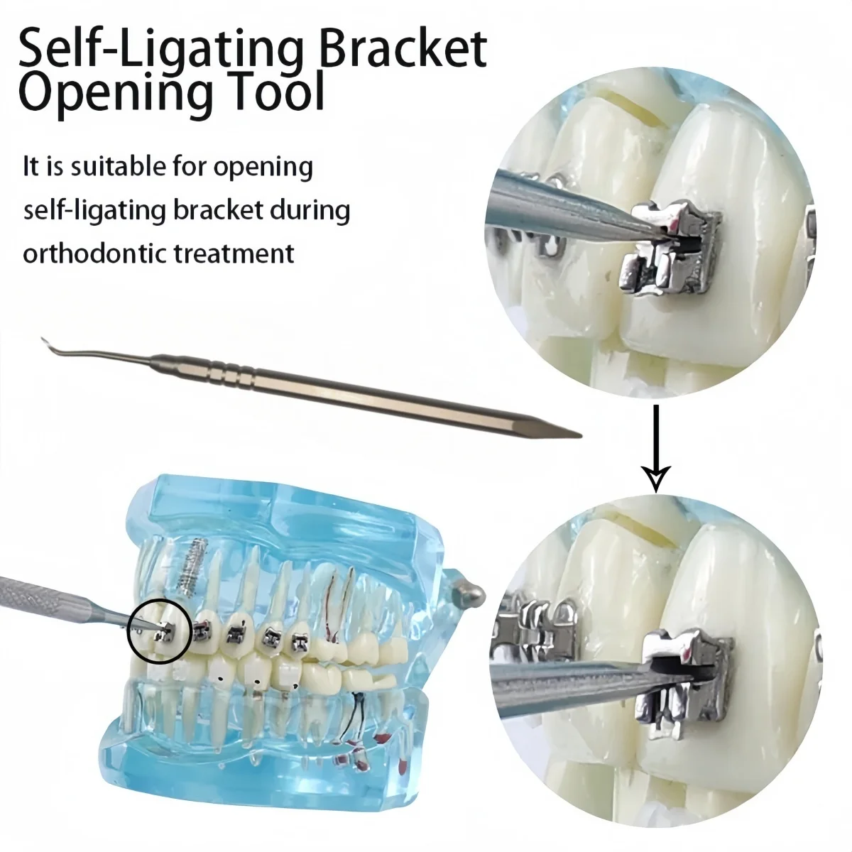 1 قطعة أداة فتح قوس الأسنان الذاتي افتتاح تقويم الأسنان الذاتي الربط السلبي قوس أدوات الفولاذ المقاوم للصدأ #2