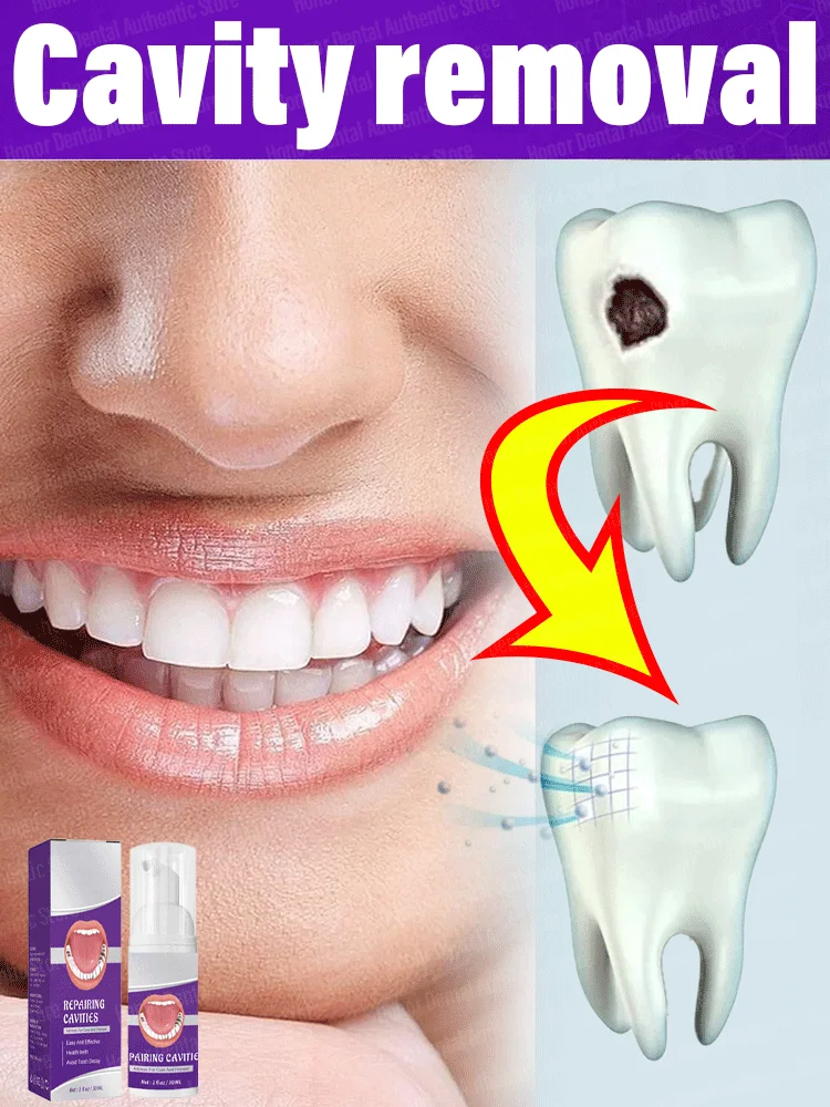 Clareamento Dente Eficaz, Removendo Placa, Melhora Placa, Periodontia, Remover Cavidades