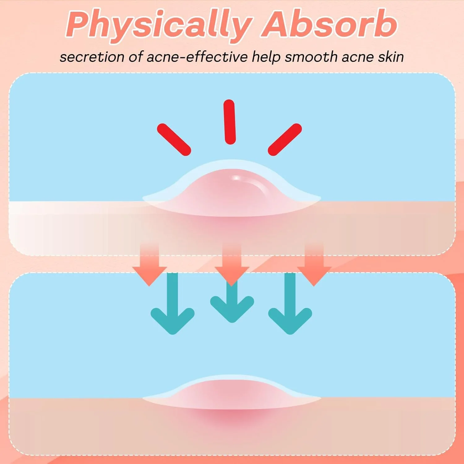 480 قطعة، رقع حب الشباب على شكل نجمة ودائرة، رقعة بثرة شفافة لاصقة شفافة ضرورية للمكياج مناسبة لأحجام مختلفة #3