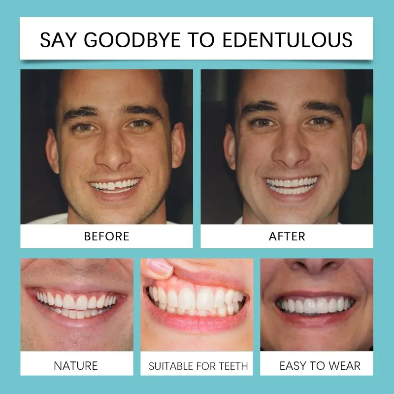 مجموعة أسنان مؤقتة قابلة للتعديل، مقاس طبيعي مريح، هدية مثالية لعيد الميلاد للرجال والنساء، منتج العناية بصحة الفم الأساسية #5