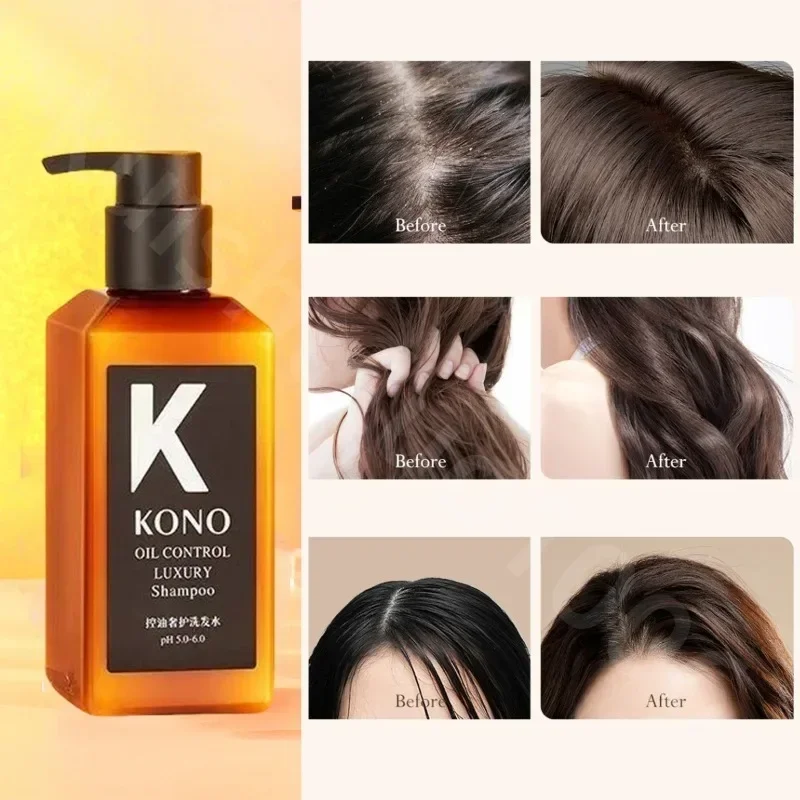 

New Upgrade KONO Oil Control Dandruff Smooth Nourishing Salon Shampoo Fluffy Hair Deep Repair Hair Follicle Care Moisturizes Dry