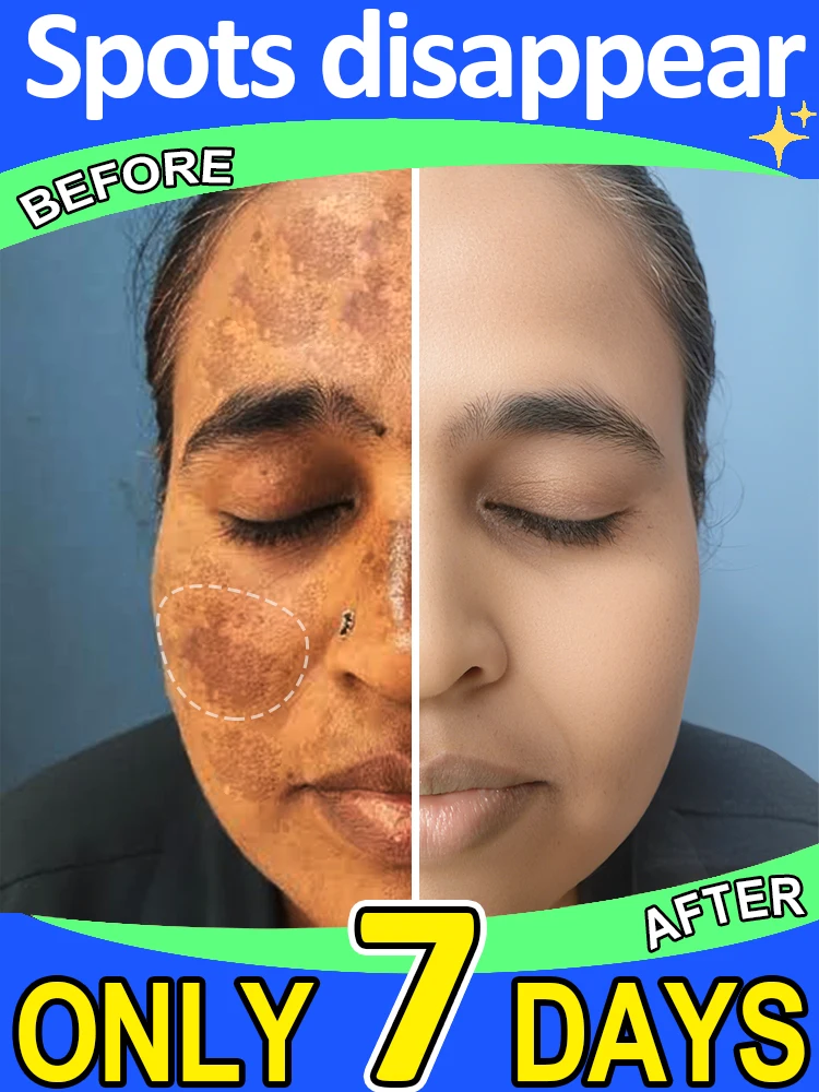 

Проблемы с стиранием пятен 100% в 7 дней.