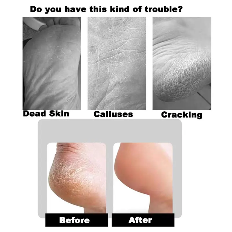 Fußfeile, professionelle Raspel, Ferse gebogene Reibe, harte abgestorbene Haut, Hornhautentferner, grobe und feine Seiten, Fußpflege-Werkzeuge