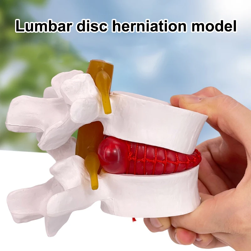 

Профессиональная поясничная модель, анатомия человека, скелет позвоночника, грыжа поясничного диска, обучающая модель, демонстрационная модель, обучающая модель