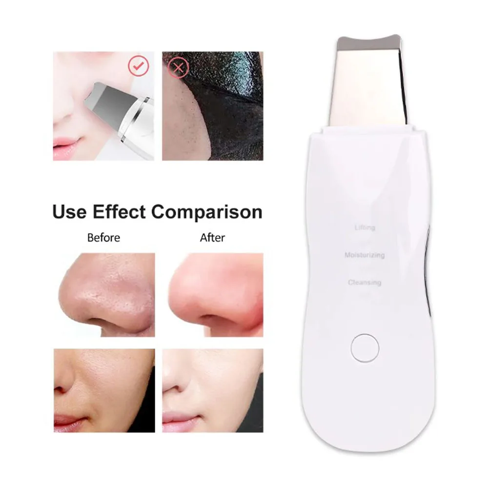 Depurador eléctrico de piel para limpieza Facial profunda, pala exfoliante, limpiador de poros faciales, eliminación de espinillas, dispositivo de elevación, herramienta de belleza