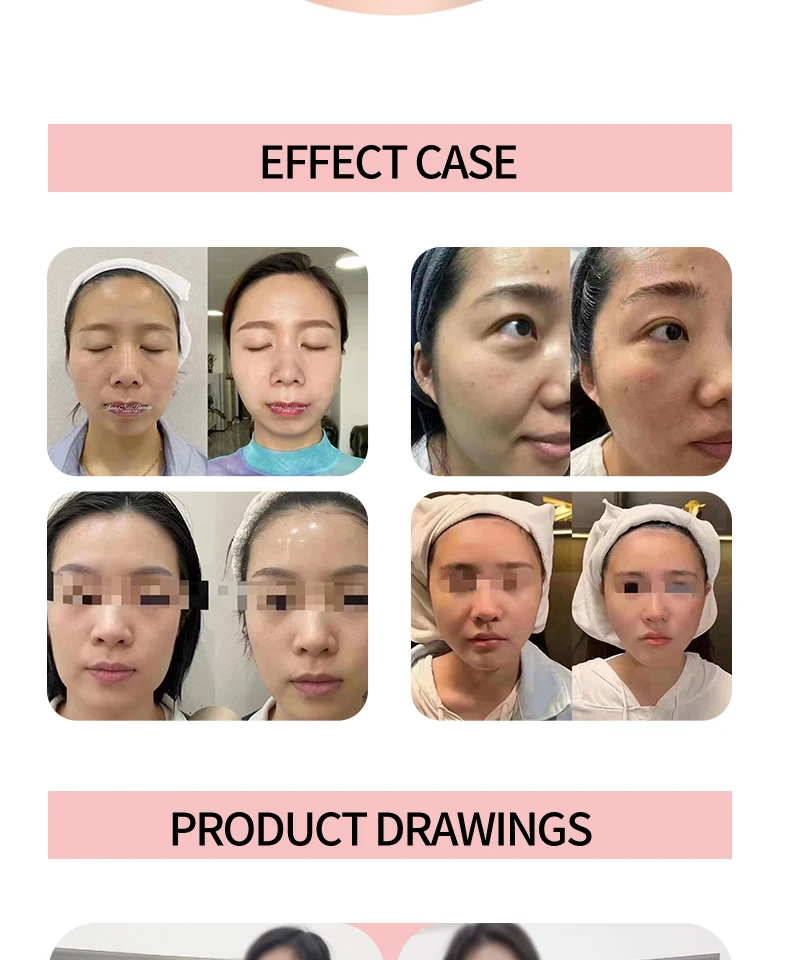 Lati Beauty Face Tightening Law Neck Wrinkles Import
