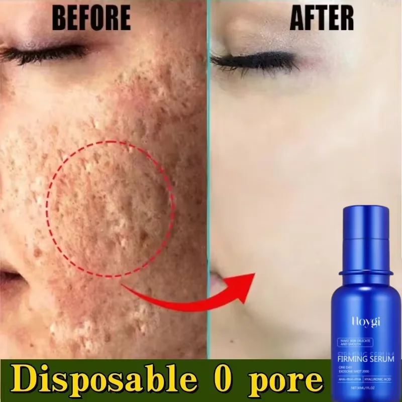 

Blue Microneedle Shrink Pores Facial Serum Whitening Lifting Firm Fade Fine Line Moisturizing Melanin Remove Skin Care Products