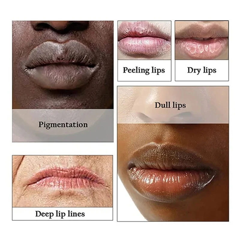 Soft Lip Serum Lip Pink Fresh Brightening Milk Whitening Moisturising Nourishing Essence Remove Black Lip Balm Treatment New