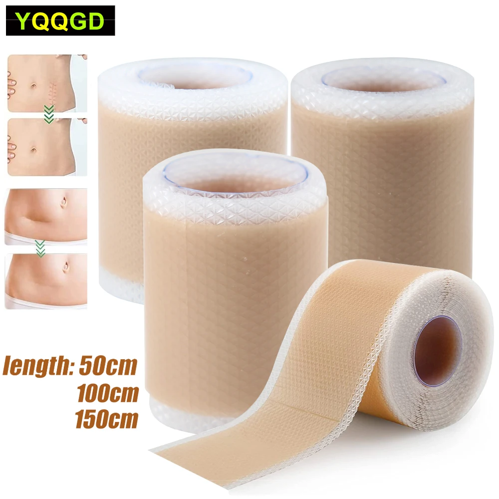 50/100/150cm Silicone Gel Scar Sheet Patch Treatment Removal Tape Acne Trauma Burn Scar Cover Skin Repair Section Ear Beauty