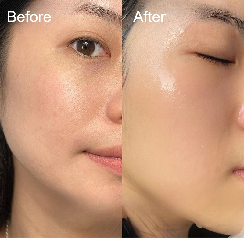 3D Siliconen Masker Cover Herbruikbare Oorhangende Hulpmasker Hydraterende Verstevigende Huidverzorging Enhancement Tool Gezichtsverzorging Tool 1 Vel