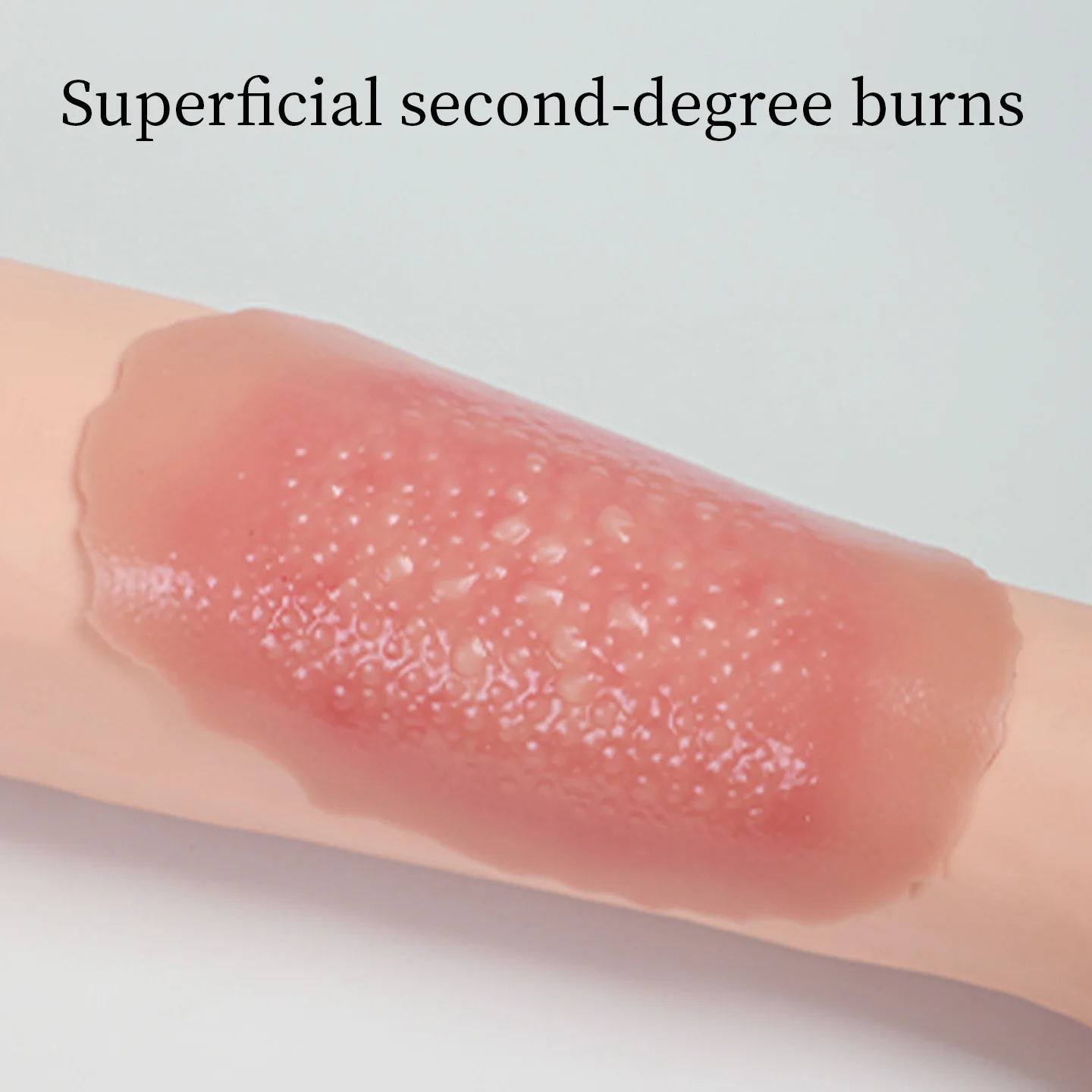 DARHMMY Levels 1–4 Adhesive-type Burn Skin Models, Skin Wound Models, Silicone Skin Models for Medical Training