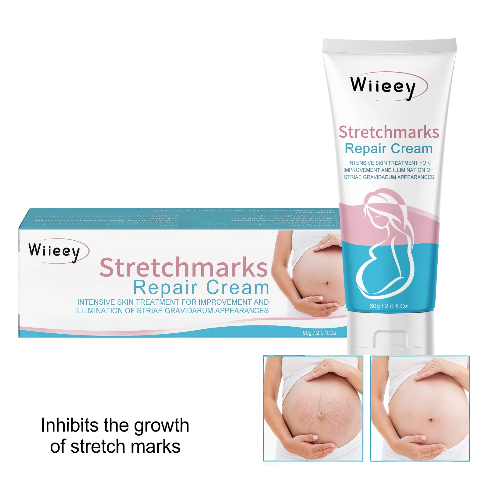 Stretchmarks Repair Cream Remove Pregnancy Firm Skin Enhance Elasticity Body Cream Nourish Moisturizing Pregnant Women Skin Care view 4