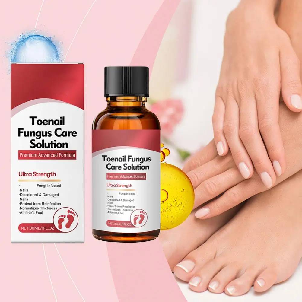 

30ml Toenail Fungus Repair Solution Nail Fungus Removal Liquid Cream Fungal Removal Nail Paronychia Anti Infection Onychomy P2Q4