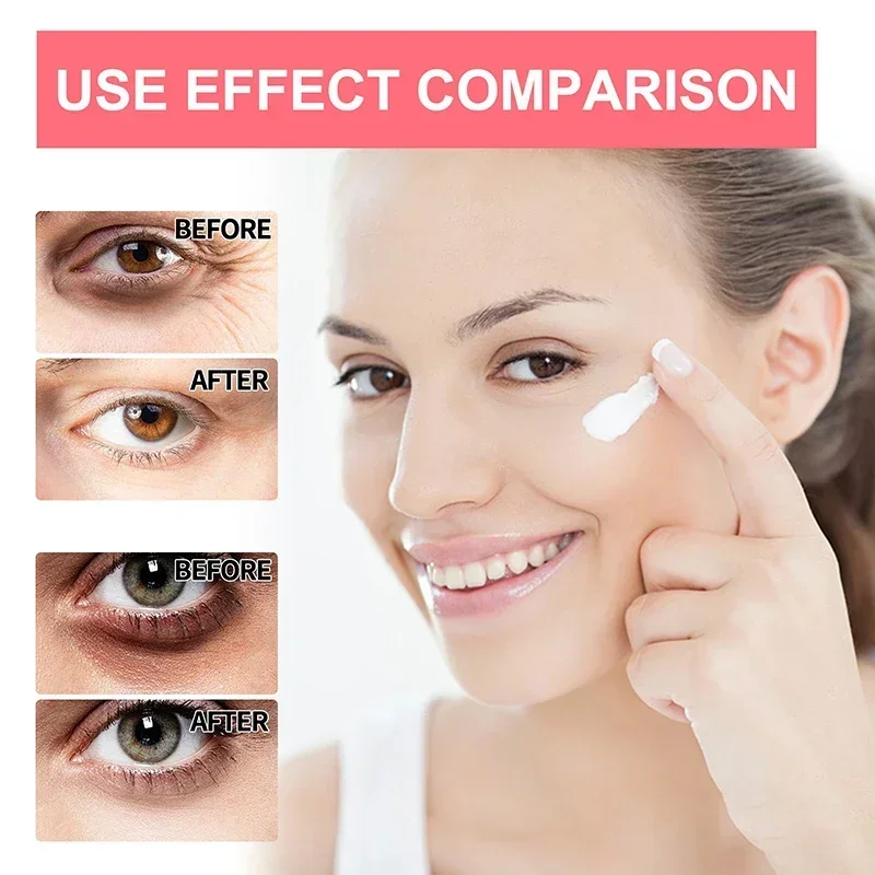 Crème anti-déformante pour les yeux, anciers de soin, rétinol, se débarrasser des cernes gonflés, lifting de la zone des yeux, blanchissant, hydratant, réparateur