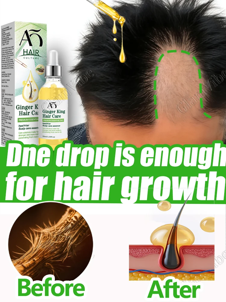 スーパープロモティングヘアグロースセラムは、頭皮を傷つけずに自信を取り戻すのに役立ちます。