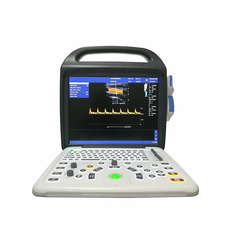 Color Doppler ultrasound diagnosis system C8 portable medical diagnosis equipment full digital color ultrasound