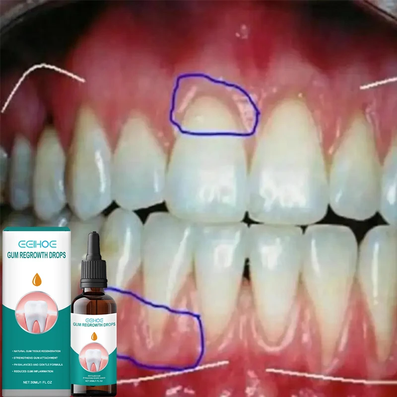 

Repair Gums Serum Effectively Relieve Tooth Allergy Dental Caries Tooth Cleaning Toothpaste Rapid Relieve Tooth Damage Drops ﻿