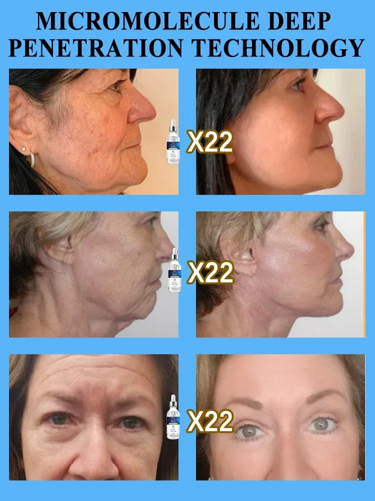 Restore your beautiful appearance